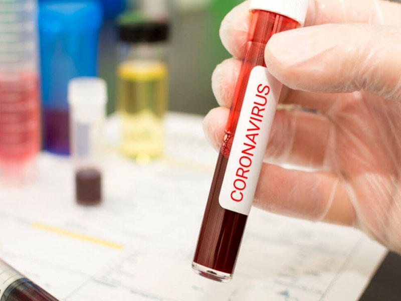 Koronavirusu zərərsizləşdirən anticisimlər aşkarlandı