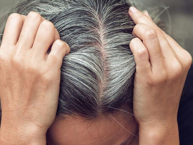 Hansı vitamin çatışmazlığı saç ağarmasına səbəb olur?