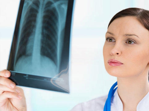 Tropik ağ ciyər eozinofiliyası