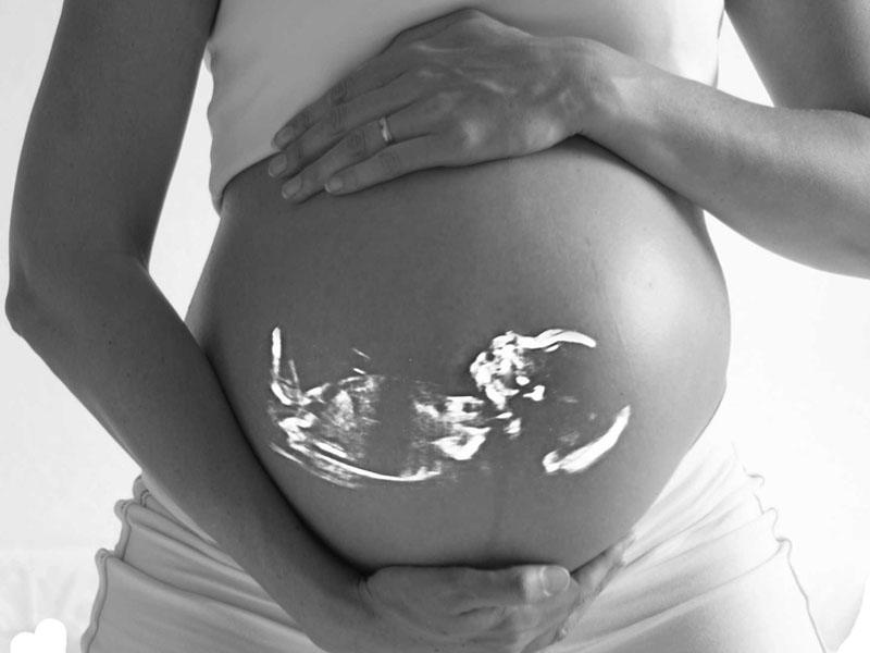 Mumyalaşmış döl və ya dölün ana bətnində ölümü