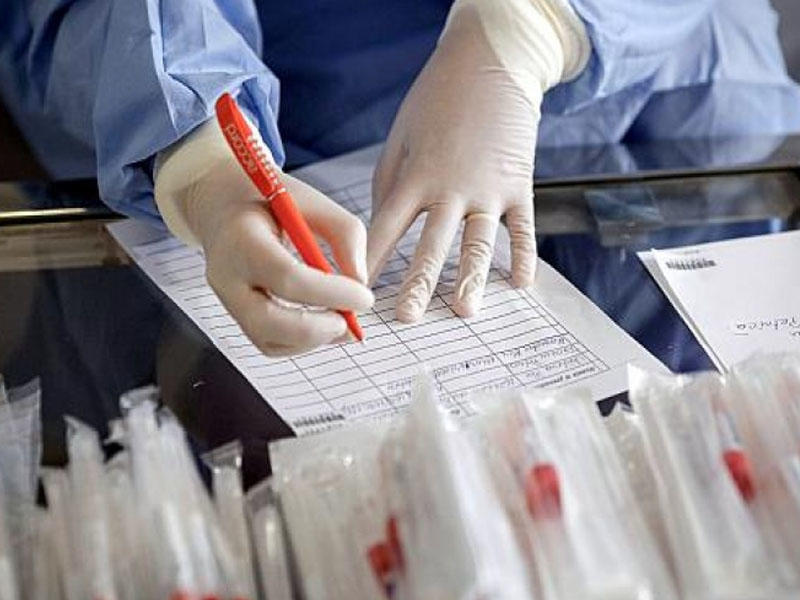 Həkim COVID-2-dən danışdı - Viral sətəlcəmdir