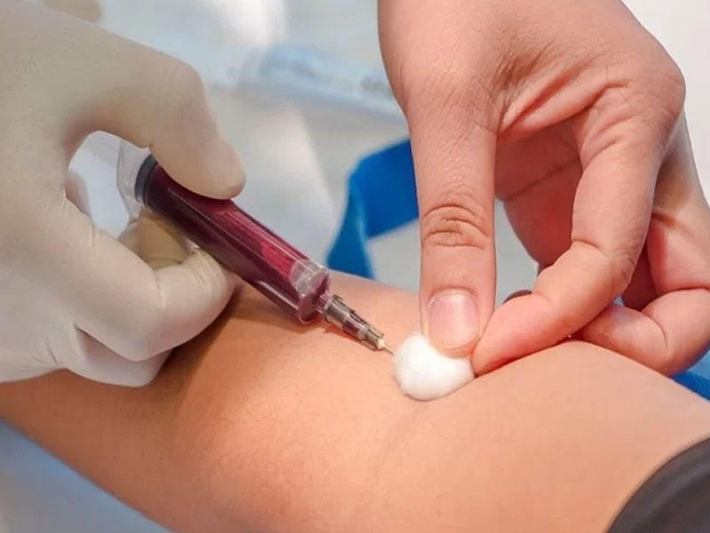 Koronavirusdan sonra mütləq qaraciyəri yoxladın - Professor