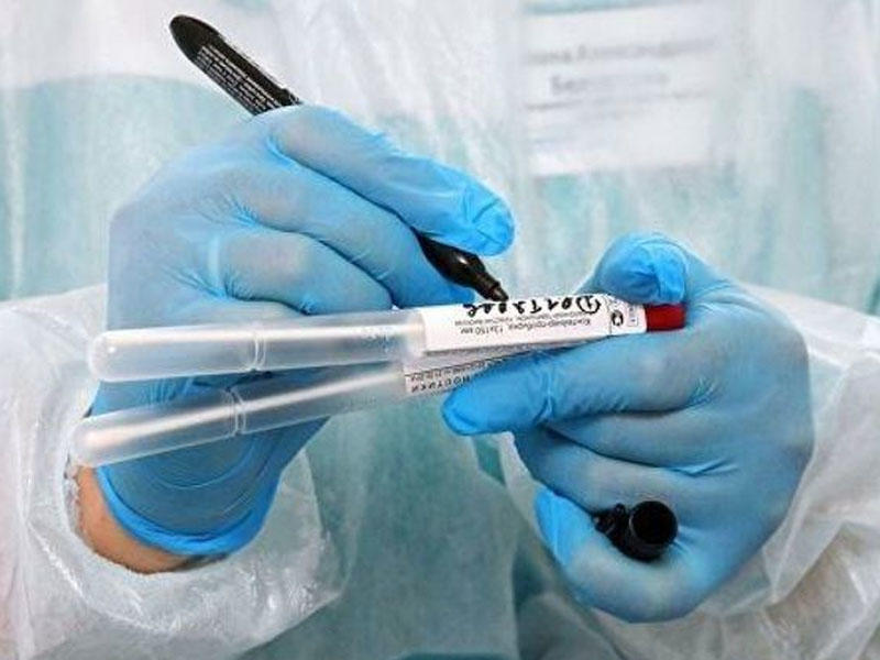 Mütəxəssislər "COVID-19"un ən pis nəticələrini müəyyən ediblər