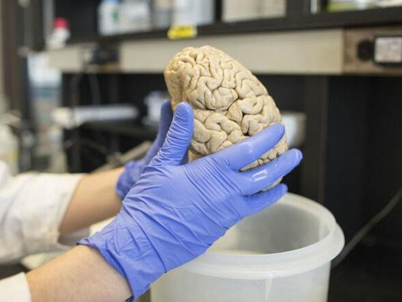 Bu qidalar beyin üçün olduqca FAYDALIDIR