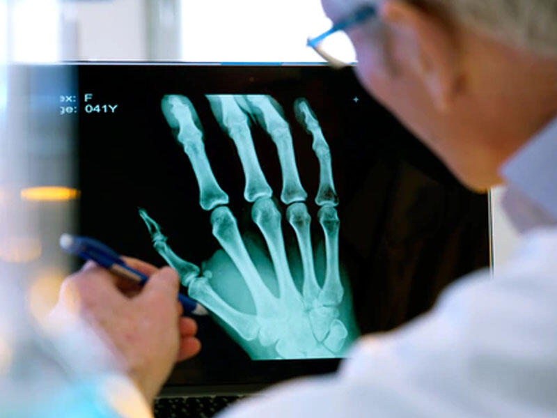 Bioloji parçalanan implantlar