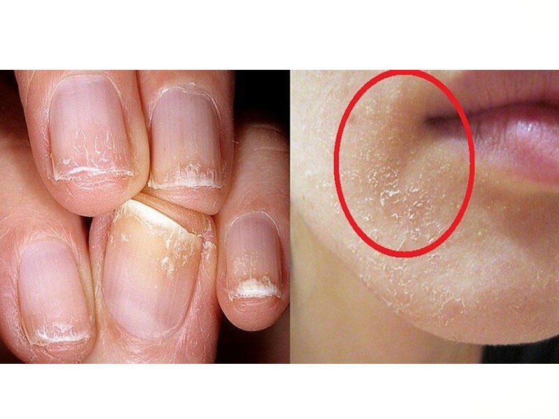 Vitamin D əskikliyini evdə özün yoxla - Sutkalıq dozanı necə və hardan almalı?