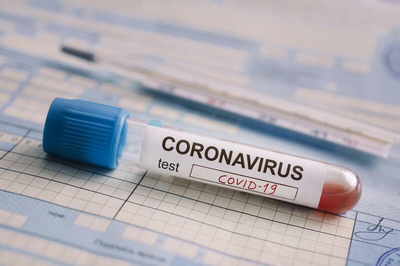 Apteklərdə satılan koronavirus testlərinə inanmaq olarmı? - Həkim açıqladı