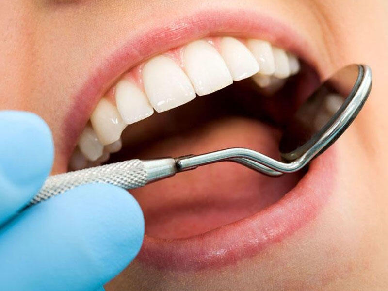 Diş tökülməsinin 70 faizi diş ətinin xəstəliklərindən qaynaqlanır - Həkim
