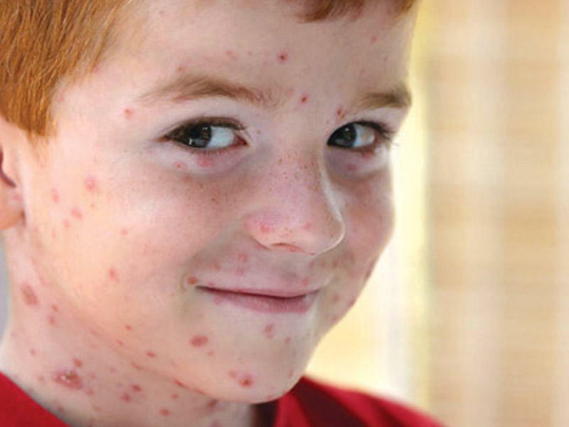 Uşaq səpib! Nə edim?