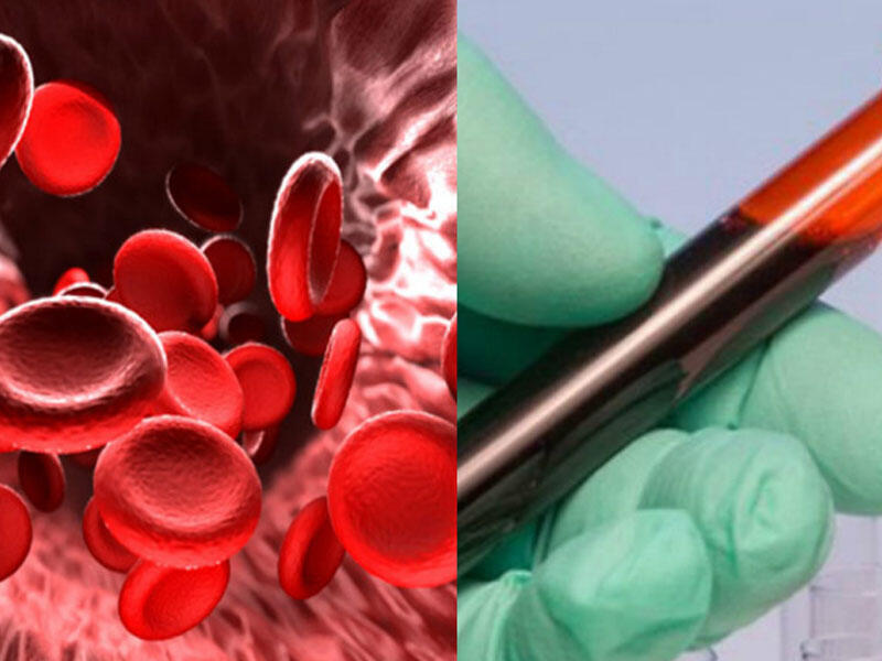 Qatı qanın səbəb olduğu BƏLAlar