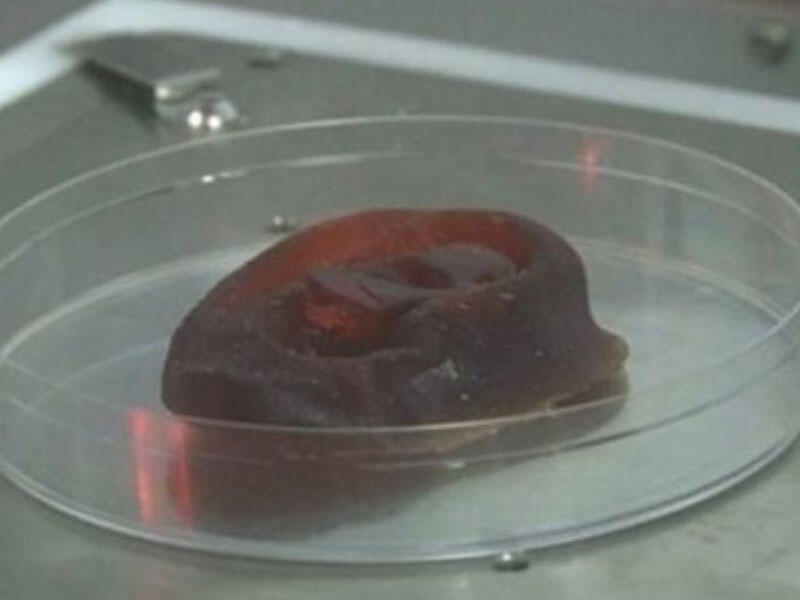 Qulaq və burun qığırdaqları 3D bioprinterdə çap olunacaq