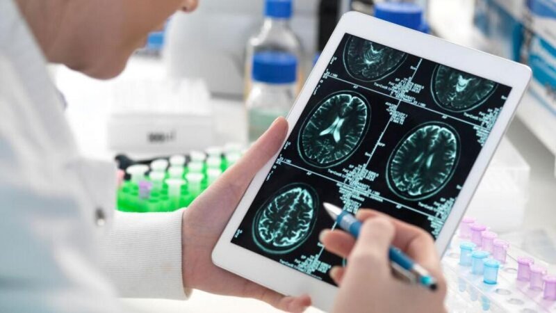 Alzheimerlə mübarizədə yeni ümid