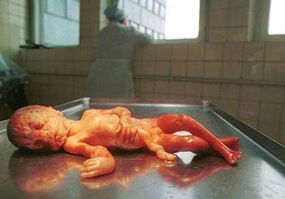 Aborta Allah qarşısında heç bir bəraət yoxdur!!! - FOTOLAR