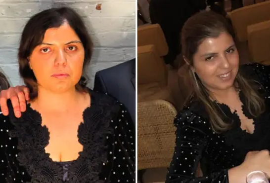 Xərçəngdən sağalan qız həşərat dişləməsindən öldü - FOTO