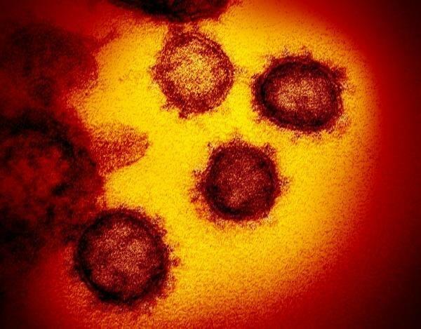 Koronavirusun görüntüləri çəkildi - FOTO