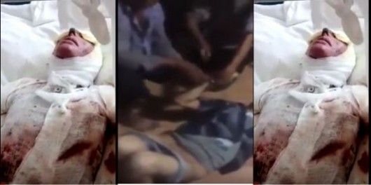 Azərbaycanlı gəlinin üzünə "kislota" tökdülər, dayısını isə soyundurub... +18 VİDEO+FOTO