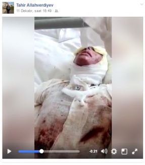 Azərbaycanlı gəlinin üzünə "kislota" tökdülər, dayısını isə soyundurub... +18 VİDEO+FOTO