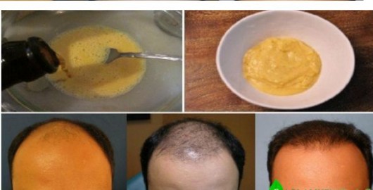 O, BANAN VƏ PİYVƏNİ QARIŞDIRDI, 7 GÜNƏ NƏTİCƏ HAMINI ŞOKA SALDI!