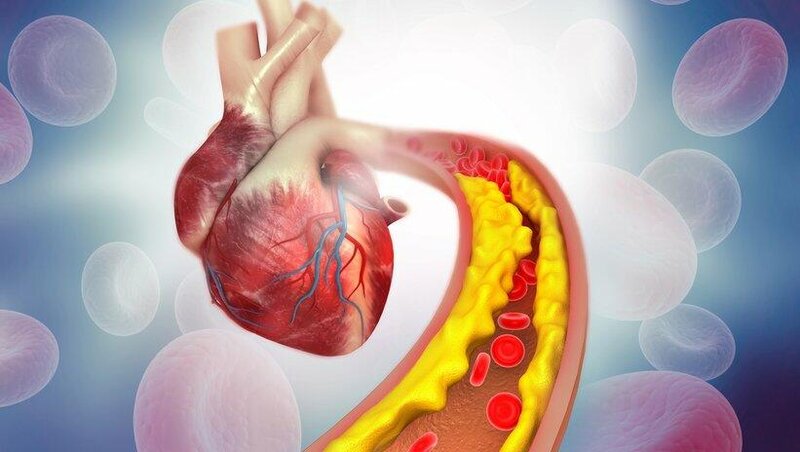 Həkim reportajı: Xolesterol dərmanlarından istifadə edərkən diqqətli olun