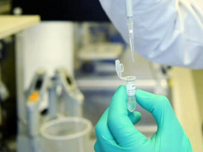 Koronavirusu qəsdən yayan adam öldü - Yaponiyada