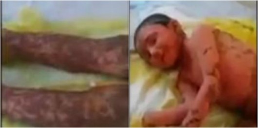Azərbaycanda həkim DƏHŞƏTİ: Yalandan pediatram deyib uşağı bu hala saldı (+18 VİDEO)