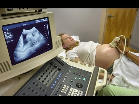 Anasının bətnində əl çalan körpənin ultrason görüntüləri yayıldı - VİDEO