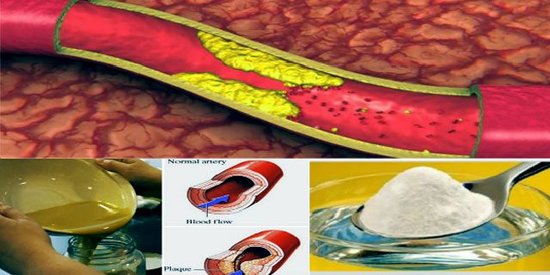 Arteriya tutulmalarına, yüksək təzyiqə qarşı hər səhər cəmi 4 qaşıq kifayətdir