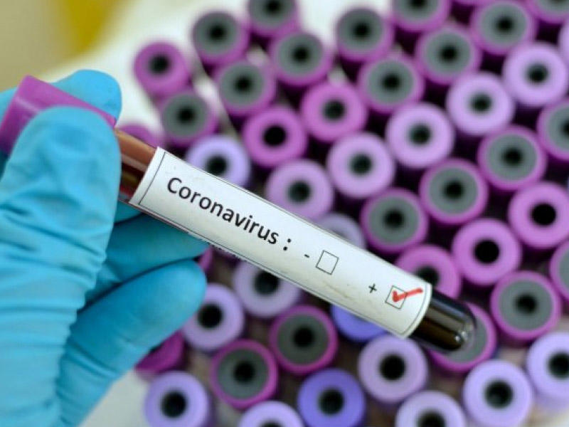 Rusiyada koronavirusa qarşı vaksinin 7 prototipi hazırlandı