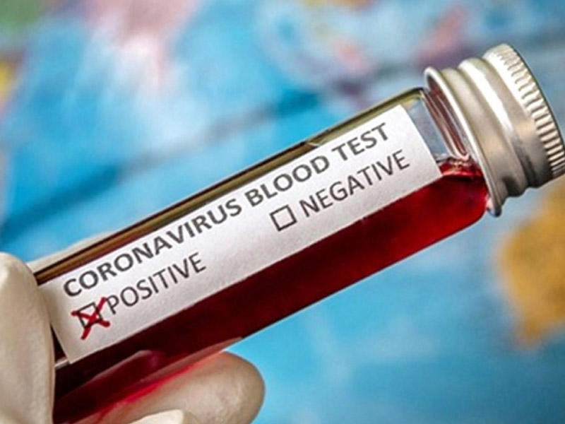 Türkiyə koronavirusun daha bir müalicə üsulunu tapdı - 15 dəqiqə ərzində...