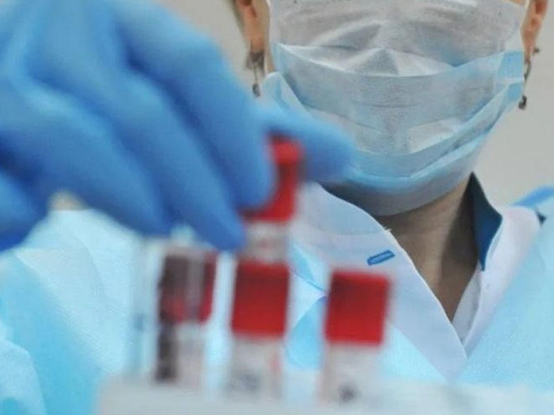 Bu gün Azərbaycanda 3656 nəfər koronavirusla bağlı test olunub