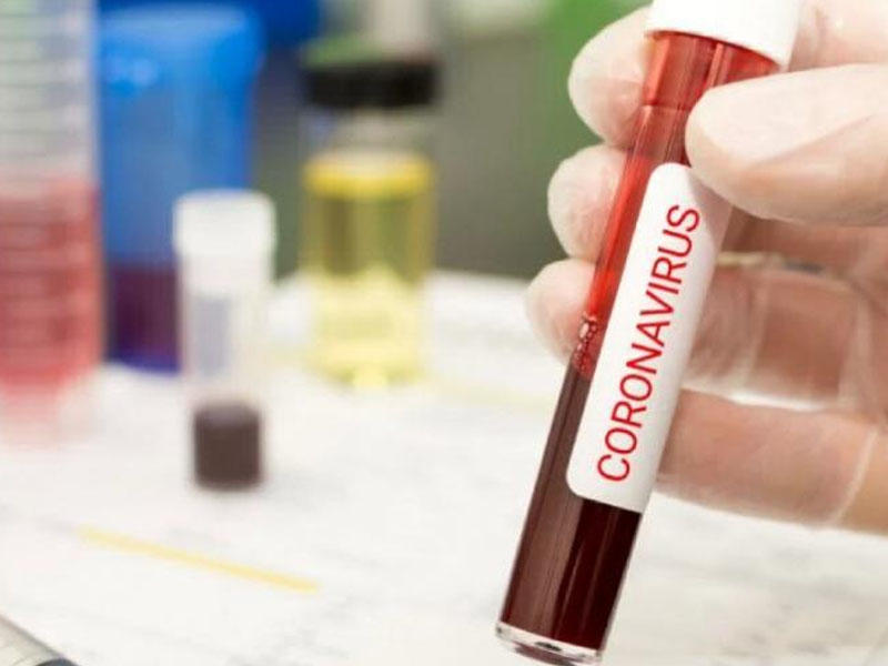 Koronavirus testləri hansı halda səhv göstərə bilər?