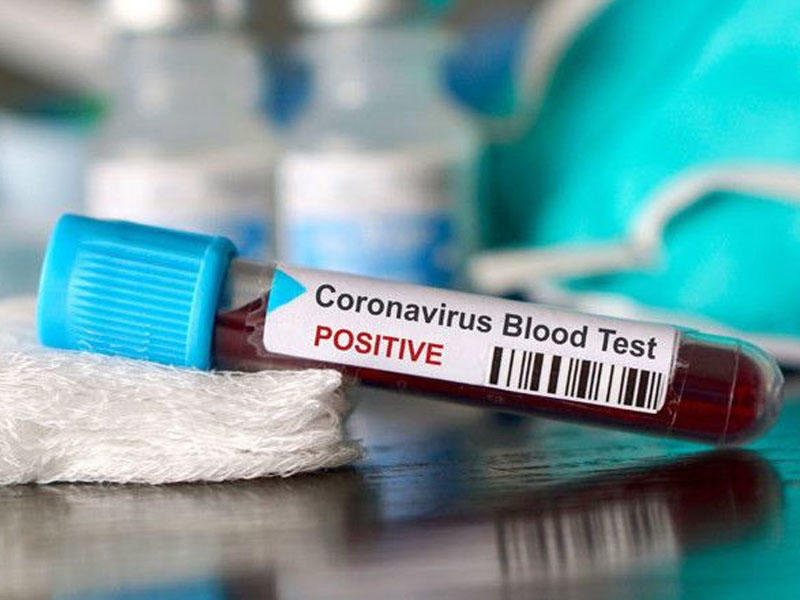 Koronavirusdan sağalmanı sürətləndirən dərmanın adı açıqlanıb