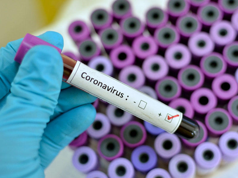 Koronavirusun neçə saat qalıcılıq qabilliyyəti var? - Dezinfeksiya Mərkəzi AÇIQLADI