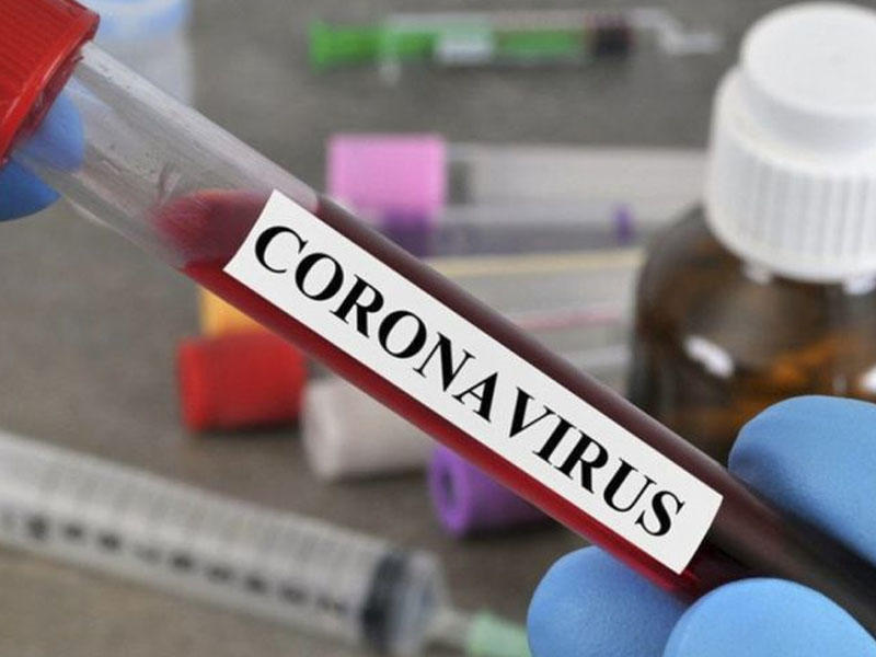 Koronavirusdan sağalanlar mütləq laxtalanma analizi verməlidir - Həkim