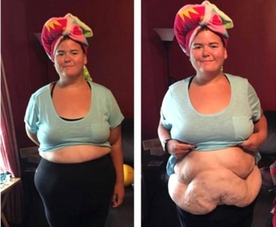 83 kiloqram arıqladı - İNANILMAZ GÖRKƏM ALDI - FOTOLAR