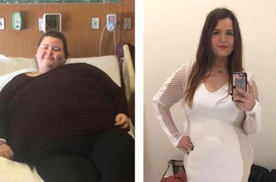 83 kiloqram arıqladı - İNANILMAZ GÖRKƏM ALDI - FOTOLAR
