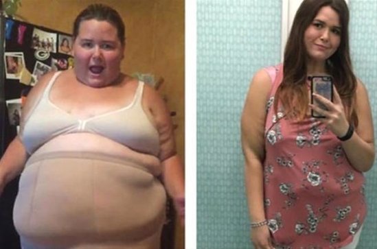 83 kiloqram arıqladı - İNANILMAZ GÖRKƏM ALDI - FOTOLAR