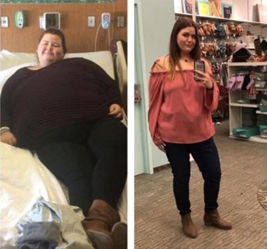 83 kiloqram arıqladı - İNANILMAZ GÖRKƏM ALDI - FOTOLAR