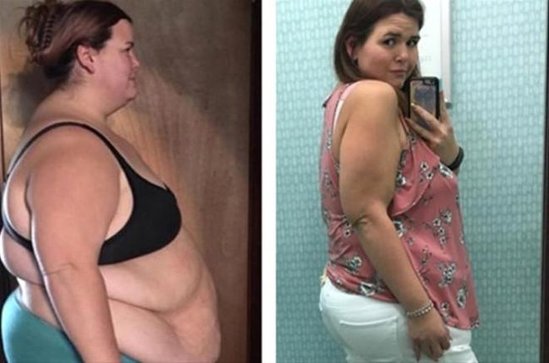 83 kiloqram arıqladı - İNANILMAZ GÖRKƏM ALDI - FOTOLAR