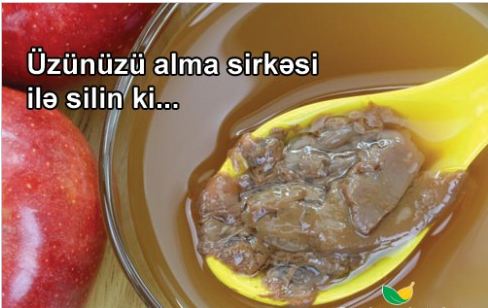 Üzünüzü alma sirkəsi ilə silin ki...