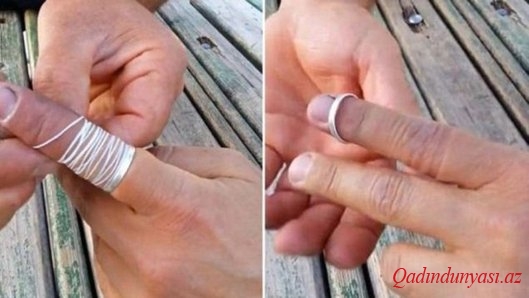 Barmaqda ilişmiş üzüyün asanlıqla çıxarılması qaydası - VİDEO