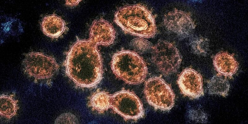 Yeni təhlükəli koronavirus aşkarlandı